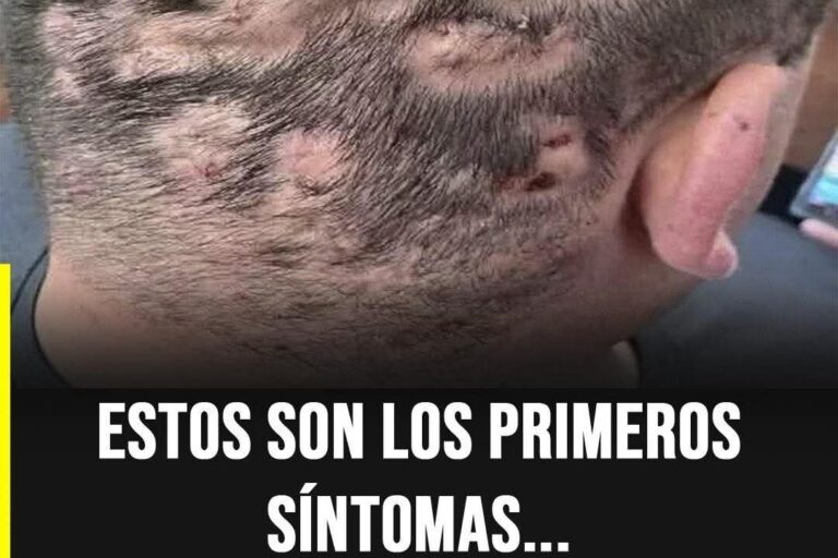 Estos son los primeros síntomas en el cuero cabelludo que podrían alertarte sobre algo más serio