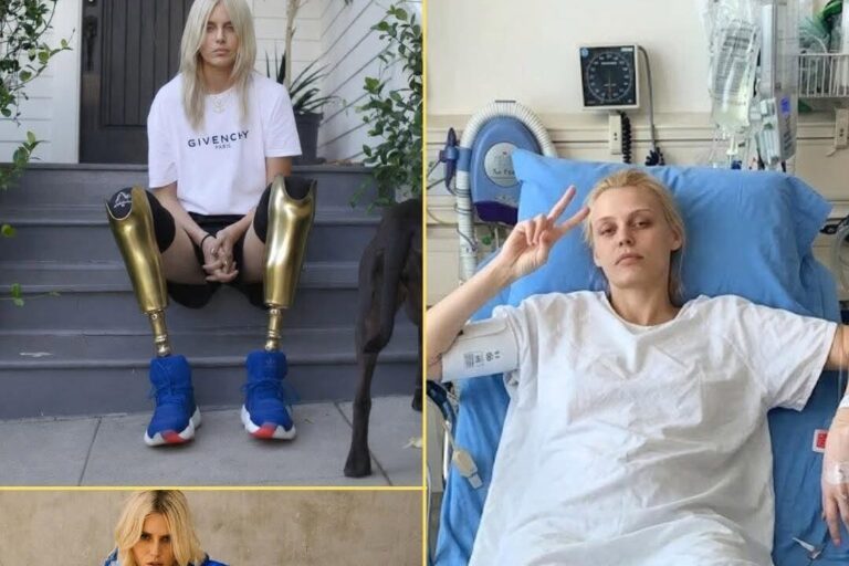 Modelo perdió ambas piernas por una infección y volvió a brillar en las pasarelas