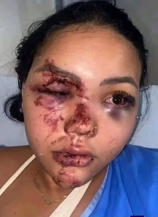 Una supuesta infidelidad terminó en una violenta confrontación y dejó una importante reflexión