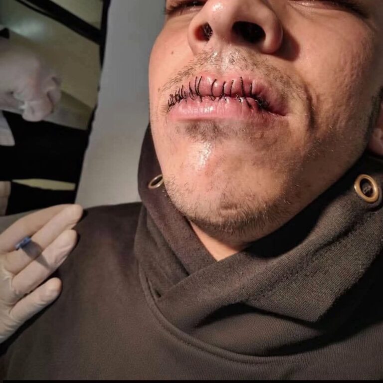 Última hora: fue secuestrado y así lo encontraron, con graves heridas en el rostro